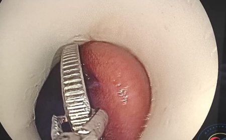 قصه الطفلة الذى تبلغ ٦سنوات داخل " مستشفى 15مايوالتخصصي "