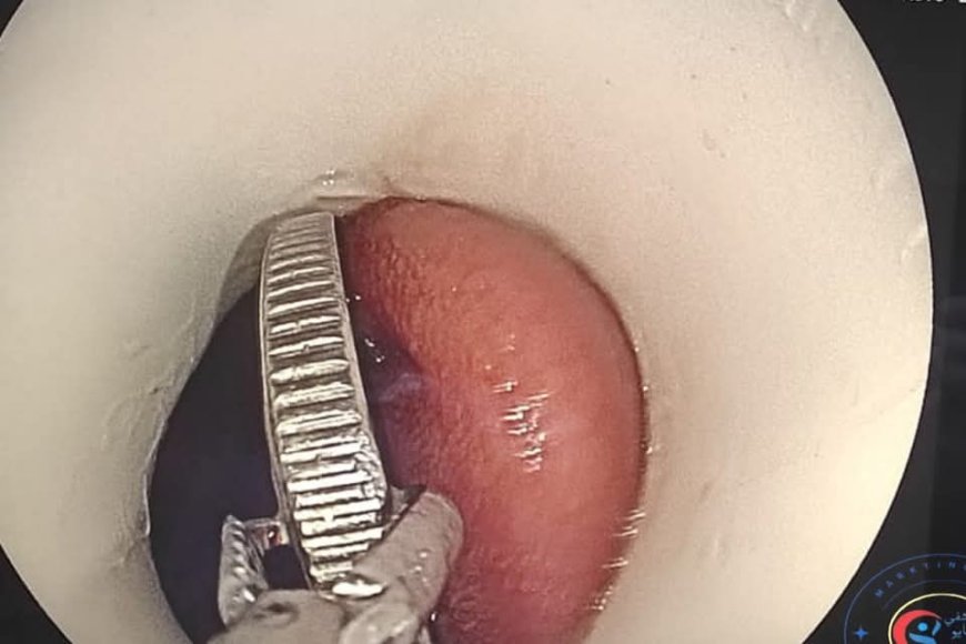 قصه الطفلة الذى تبلغ ٦سنوات داخل " مستشفى 15مايوالتخصصي "