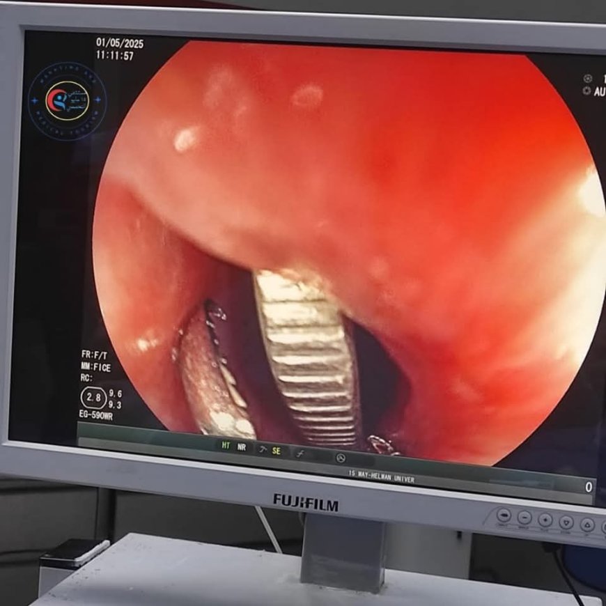 قصه الطفلة الذى تبلغ ٦سنوات داخل " مستشفى 15مايوالتخصصي "