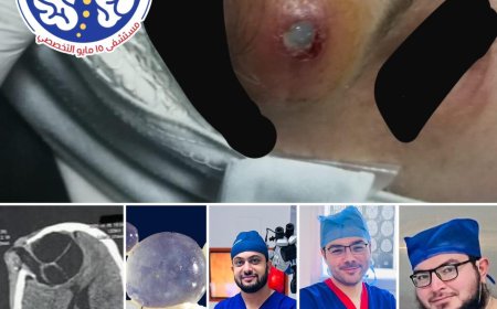 الصداع المزمن إلى الجراحة المنقذة للحياة : قصة انتصار الطب على كيس مائي بالمخ بفضل الله