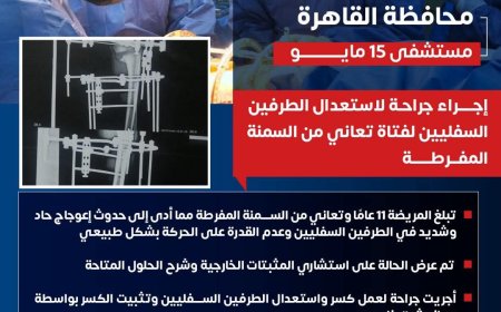 " مستشفى ١٥ مايو  النموذجي " تتصدى المركز الأول بمجهودات فريق و جراحات العظام المتقدمة إنقاذ فتاة تبلغ من العمر 11 عاما تعانى من السمنه المفرطه