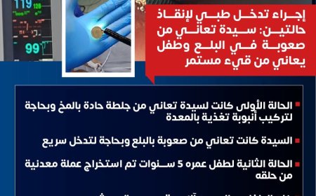 " مستشفى ١٥ مايو  النموذجي " تتصدى المركز الأول ديما بمجهودات فريق الجهاز الهضمي  لسيدة بحاجة لتركيب أنبوبة تغذية بالمعدة