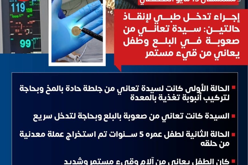 " مستشفى ١٥ مايو  النموذجي " تتصدى المركز الأول ديما بمجهودات فريق الجهاز الهضمي  لسيدة بحاجة لتركيب أنبوبة تغذية بالمعدة
