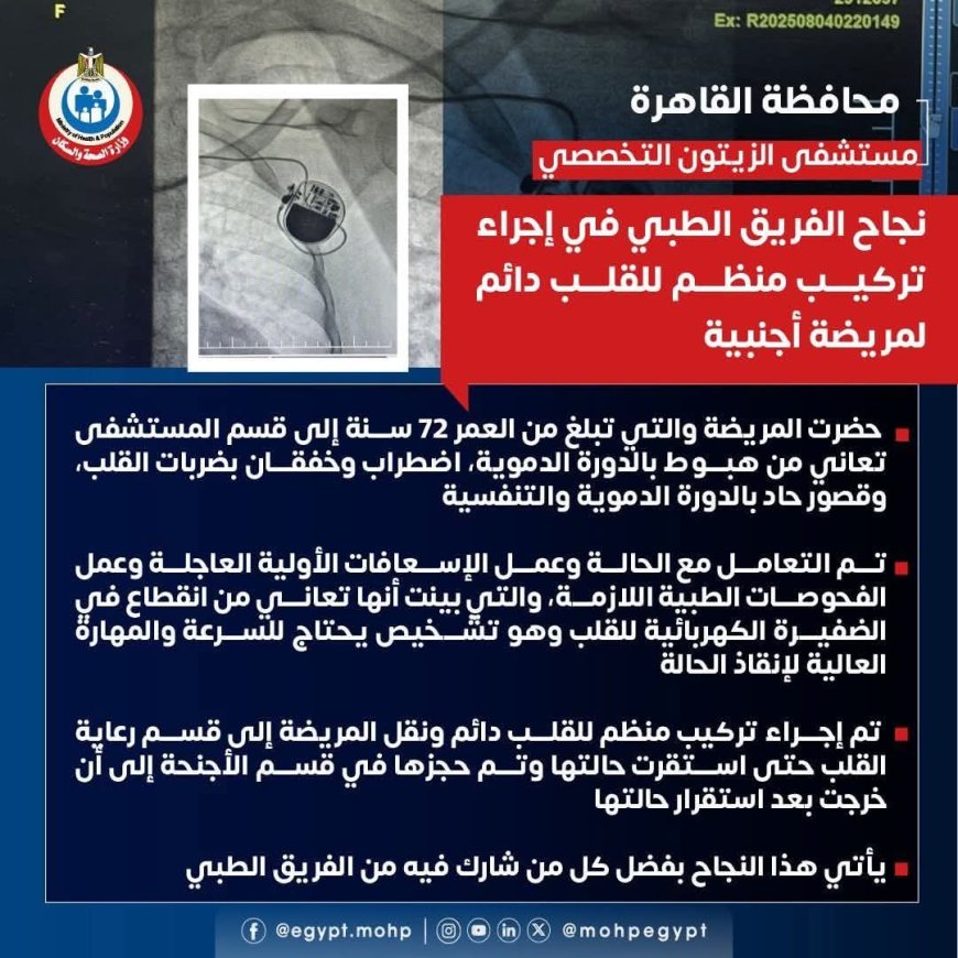 " أمانة المراكز الطبية المتخصصة " تنجح  في إجراء تركيب منظم للقلب دائم لمريضة أجنبية تبلغ من العمر  ٧٢ سنة مستشفى الزيتون التخصصى