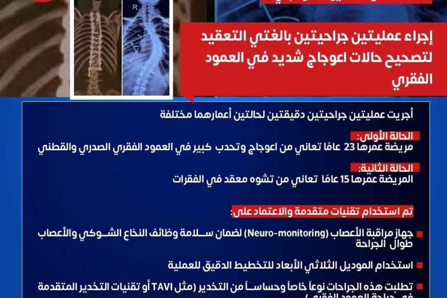 " مستشفى ١٥ مايو  النموذجي " تتصدى المركز الأول  بمجهودات إنجاز طبي جديد في جراحة العمود الفقري
