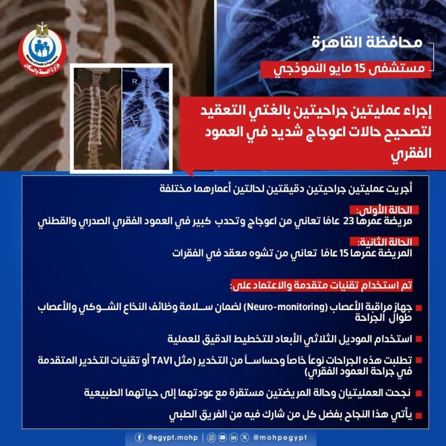 " مستشفى ١٥ مايو  النموذجي " تتصدى المركز الأول  بمجهودات إنجاز طبي جديد في جراحة العمود الفقري