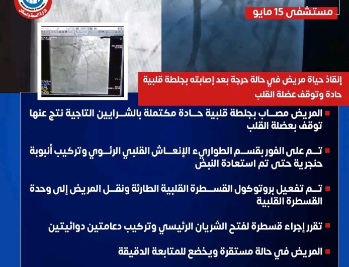" مستشفى ١٥ مايو  النموذجي " تتصدى المركز الأول  بمجهودات إنجاز طبي جديد في قسم القلب