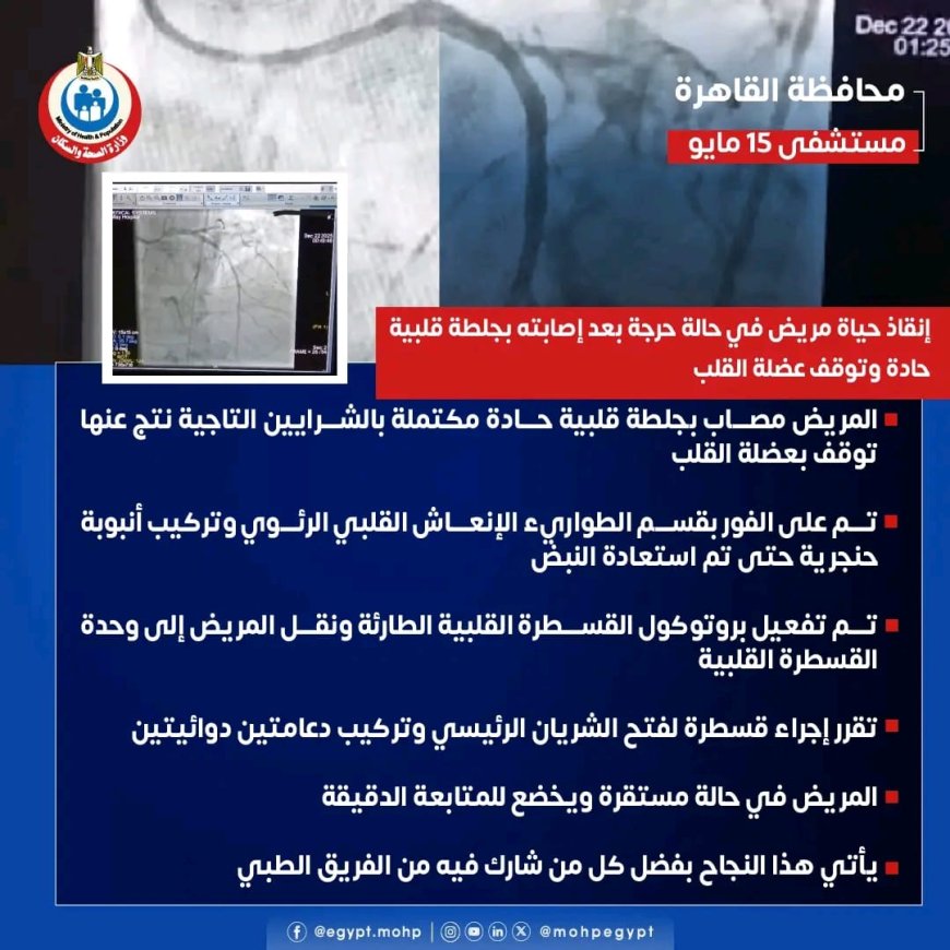 " مستشفى ١٥ مايو  النموذجي " تتصدى المركز الأول  بمجهودات إنجاز طبي جديد في قسم القلب