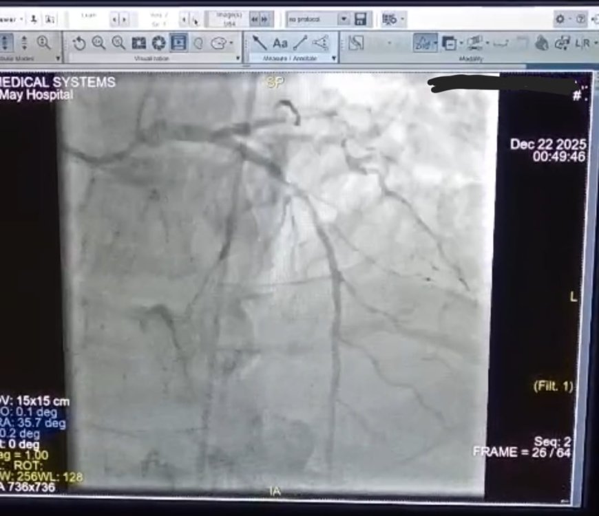 " مستشفى ١٥ مايو  النموذجي " تتصدى المركز الأول  بمجهودات إنجاز طبي جديد في قسم القلب