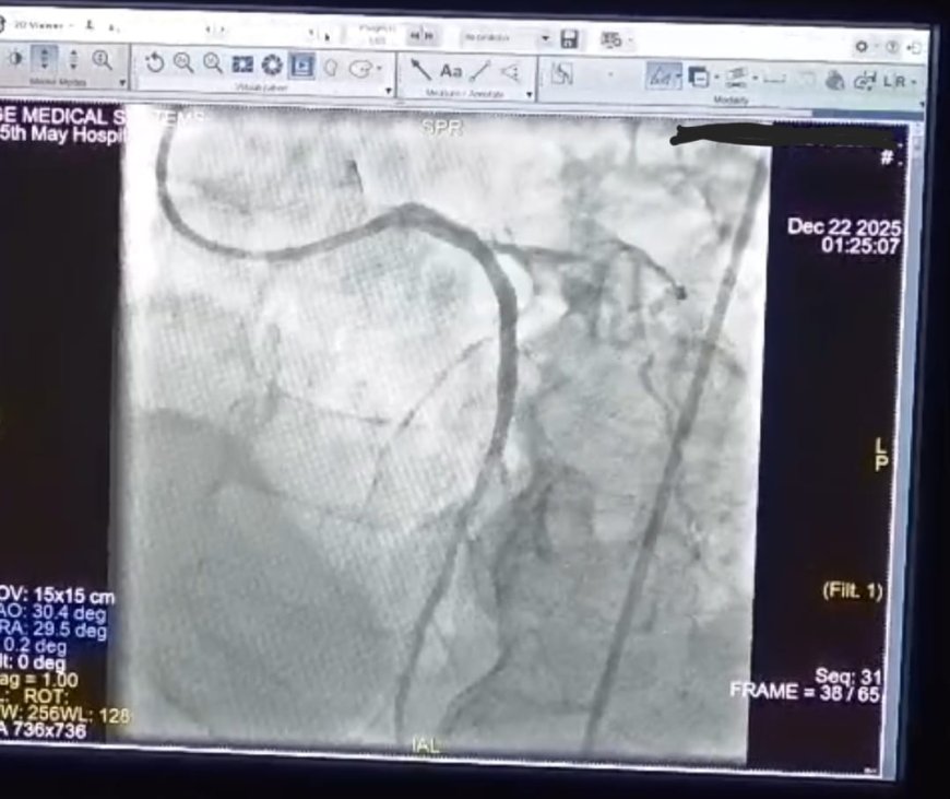 " مستشفى ١٥ مايو  النموذجي " تتصدى المركز الأول  بمجهودات إنجاز طبي جديد في قسم القلب