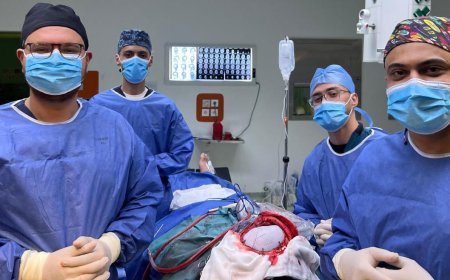 وزارة الصحة تعلن نجاح جراحة دقيقة لترقيع عظام الجمجمة بمستشفى 15 مايو النموذجي