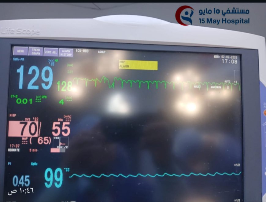 نجاح أول تدخل طبي دقيق لمولود حديث الولادة بمستشفى 15 مايو التخصصي