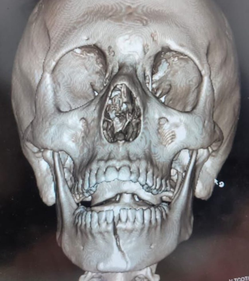 عيادات الأسنان تقدم خدماتها لـ428 مريضًا خلال عيد الفطر المبارك.. ونجاح جراحة وجه وفكين عاجلة بمستشفى عين شمس العام