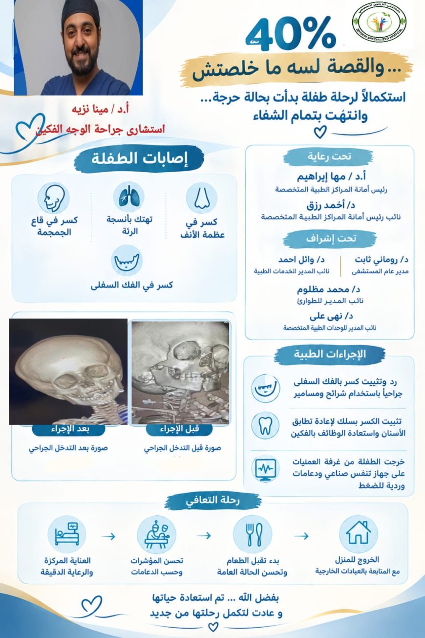 من حافة الخطر إلى تمام الشفاء.. أبطال مستشفى الزيتون التخصصي ينقذون حياة طفلة 5 سنوات سقطت من الدور الخامس
