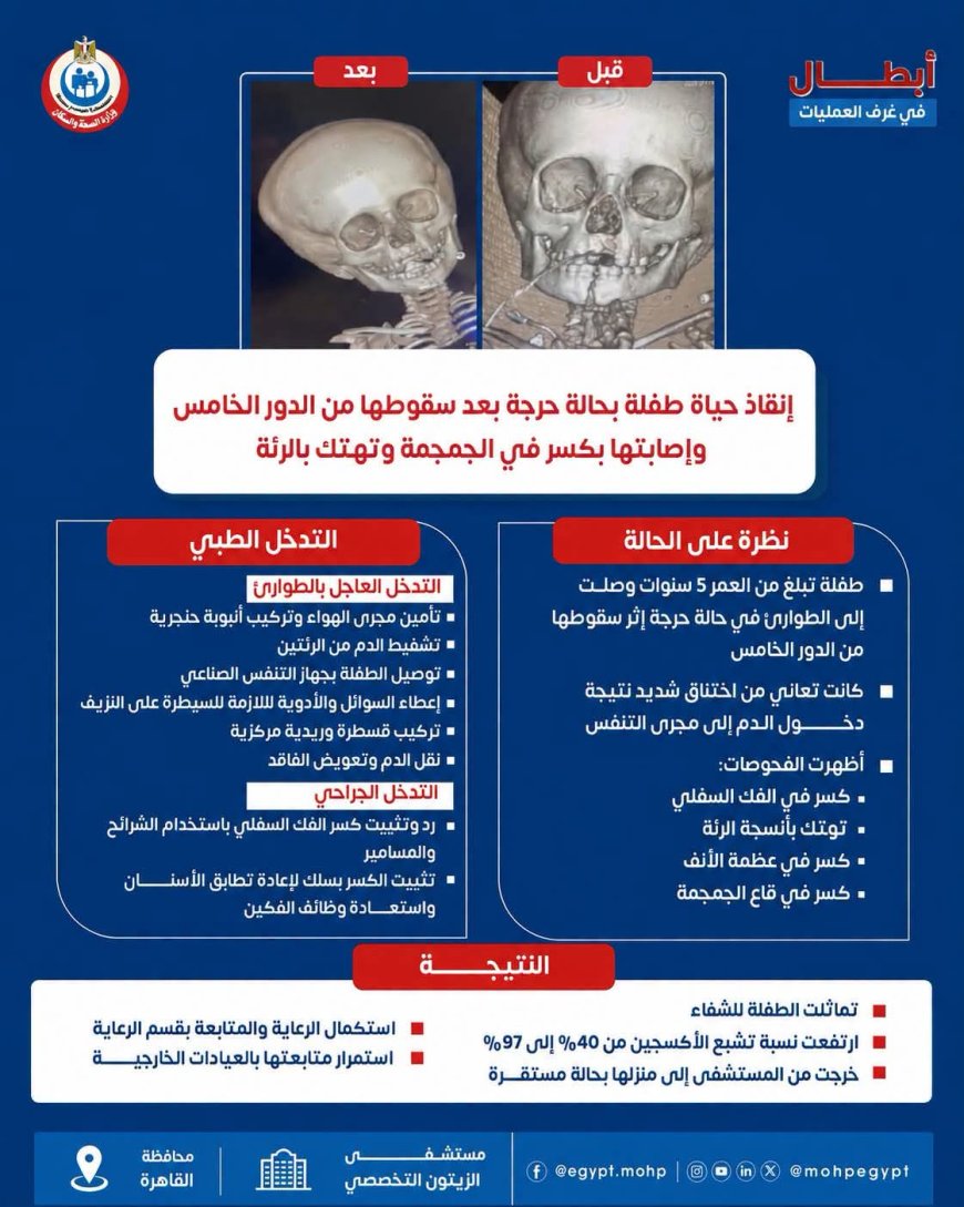من حافة الخطر إلى تمام الشفاء.. أبطال مستشفى الزيتون التخصصي ينقذون حياة طفلة 5 سنوات سقطت من الدور الخامس